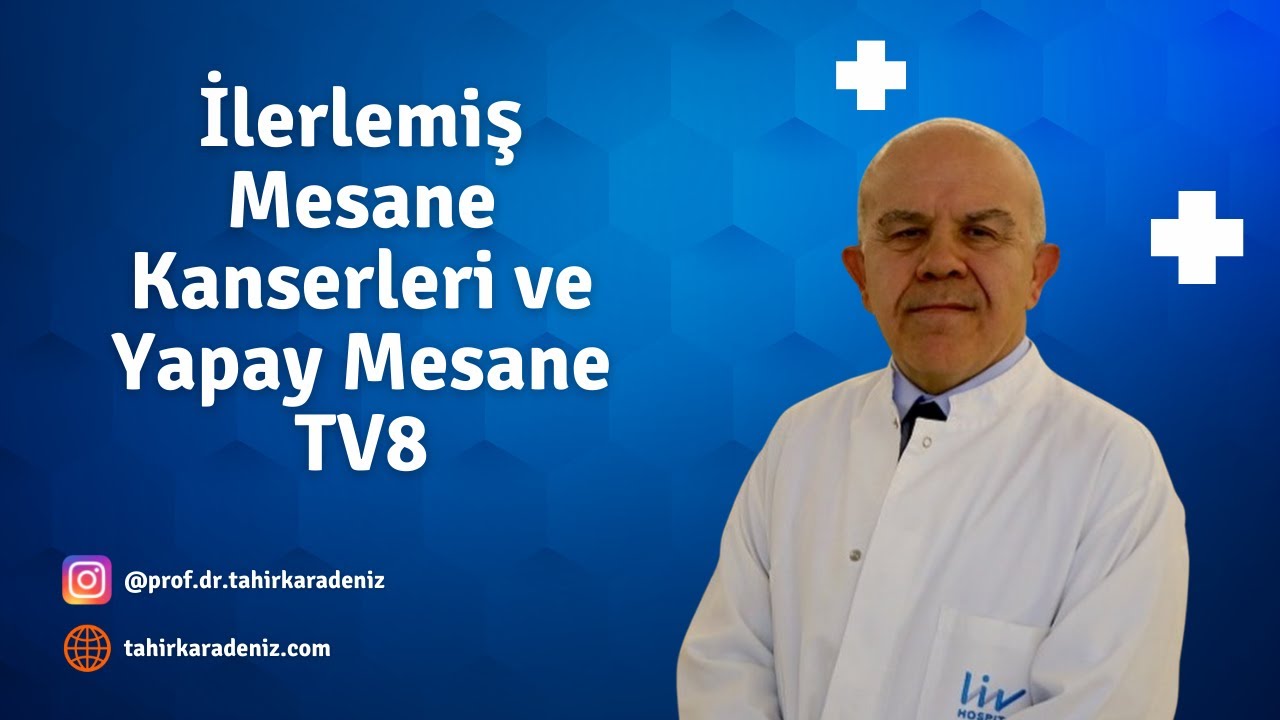 İlerlemiş Mesane Kanserleri ve Yapay Mesane - TV 8