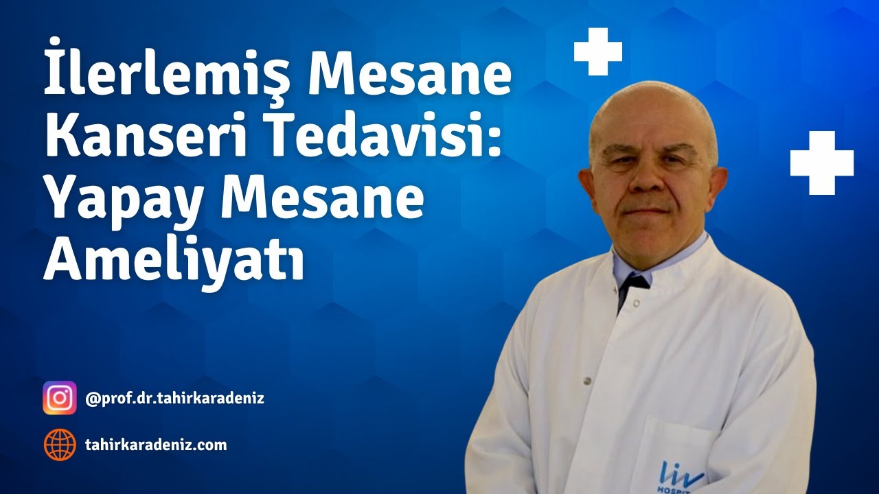 İlerlemiş Mesane Kanseri Tedavisi: Yapay Mesane Ameliyatı
