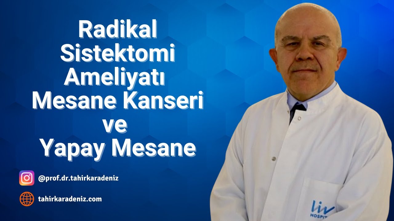 Radikal Sistektomi Ameliyatı Mesane Kanseri ve Yapay Mesane
